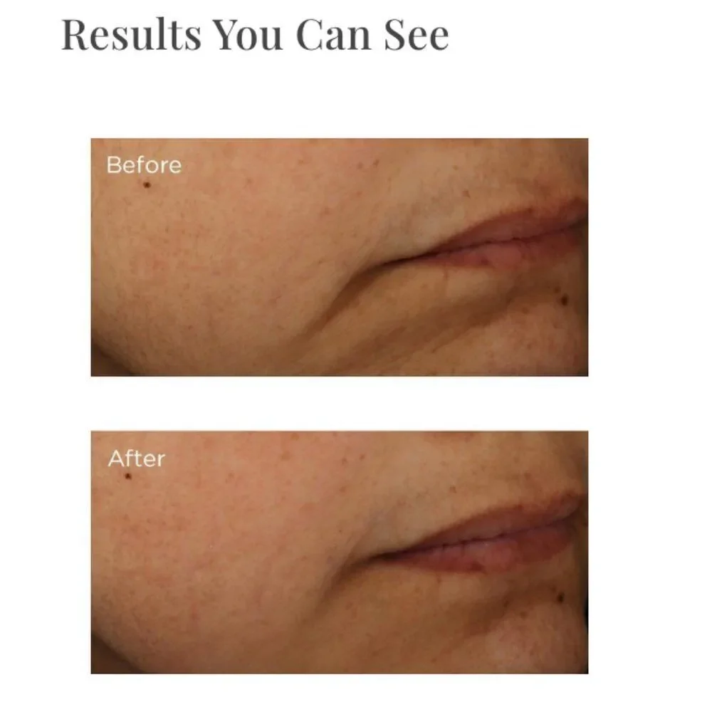 Perricone MD product stars